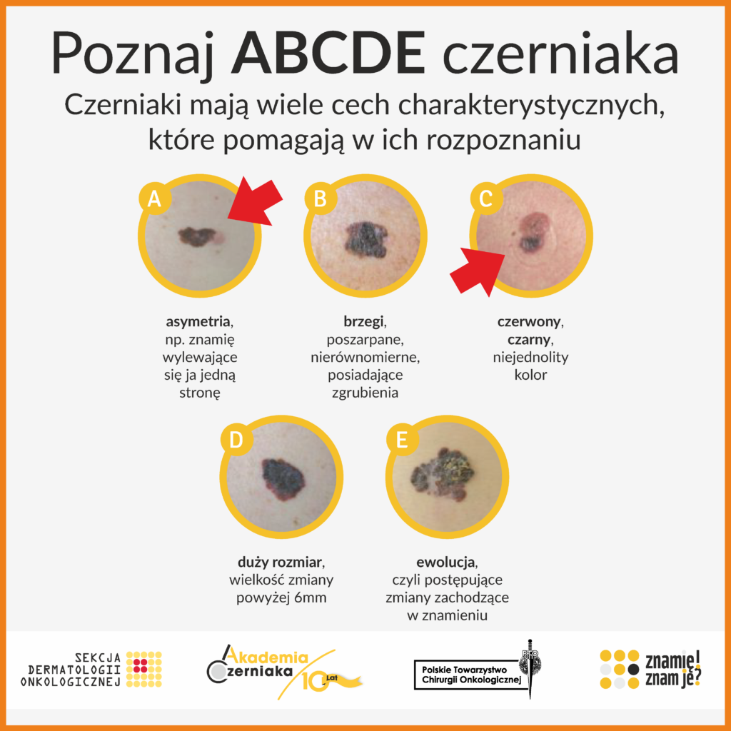 zasady ochrony skóry